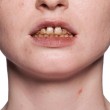 Émail pour dents ivory